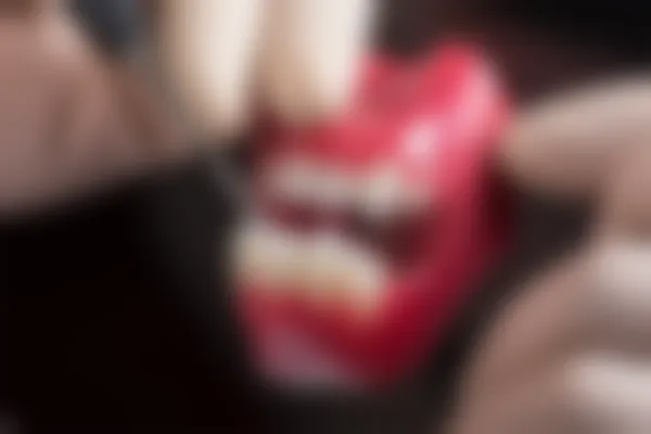 儿童乳牙是否需要进行根管治疗？了解乳牙根管治疗的重要性与必要性。