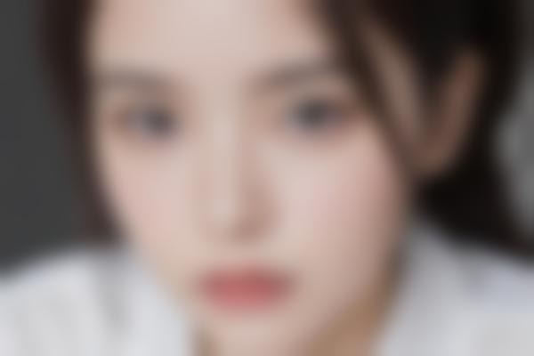 1、孙大山医生吸脂技术