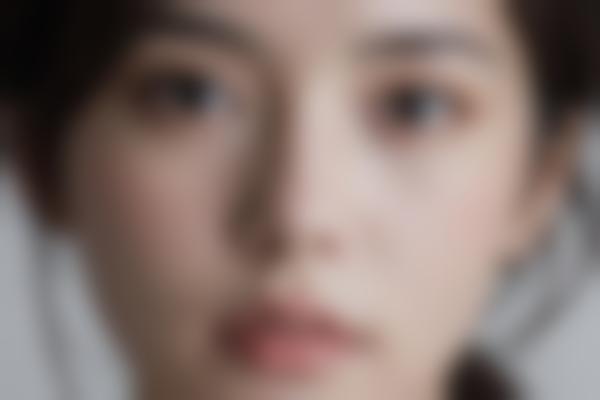 大庆艾尚美颜陈涛医生拉皮手术好吗？陈涛整形神手技术详解，全脂肪管理存活率90%+！