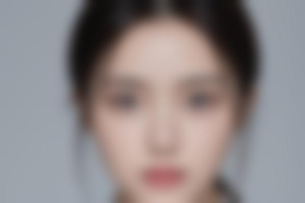 曲胜医生擅长项目
