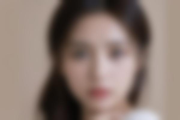 太原华晋医院郭霞医生整形技术好吗？郭霞医生眼部鼻部综合2万起自然又精致！