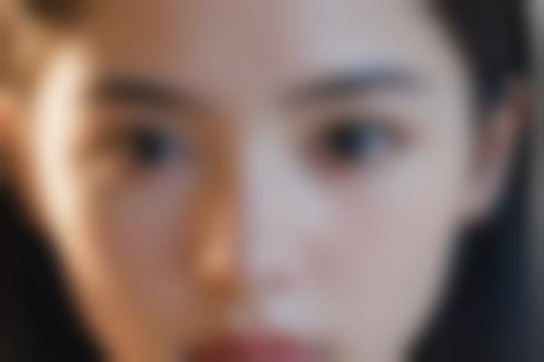 为什么选择曹阳医生做眼部整形修复？