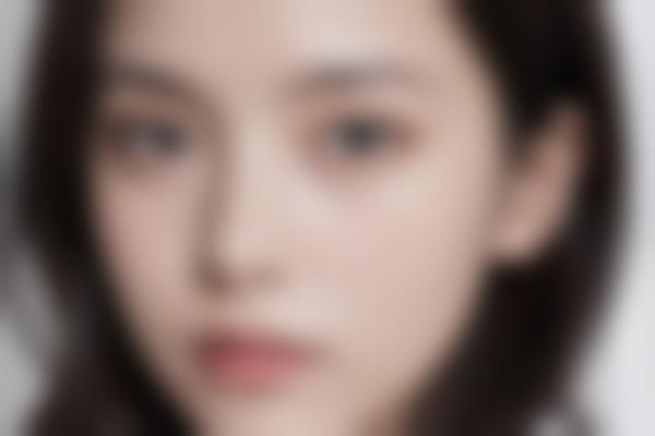 邯郸李婷整形外科门诊部秋波眼修复好，李婷医生九点定颜术价格1万起塑造自然神态美！