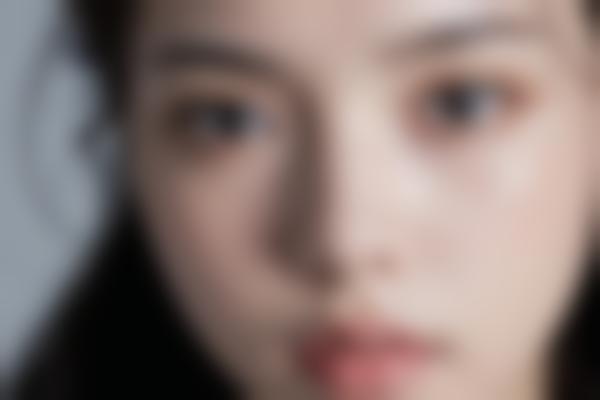 曲胜医生整形技术可靠