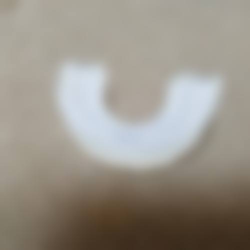 郑州小天鹅口腔医院真实实例：见证神奇改变