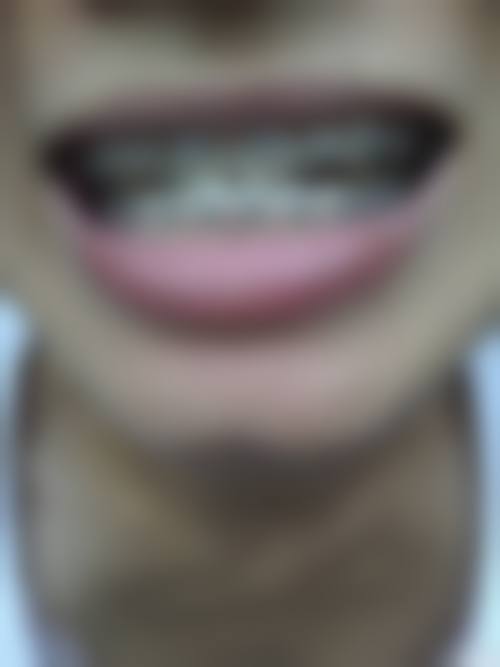 韩国SU牙科执业信息：靠谱有保护