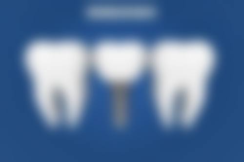 八十岁老人拔牙在南通中诺口腔怎么样？