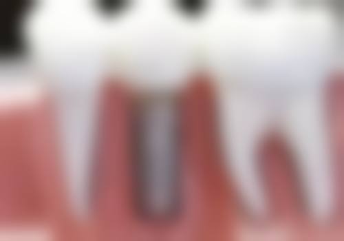 赣州陈庆洲口腔电话号码：便捷沟通询问无忧