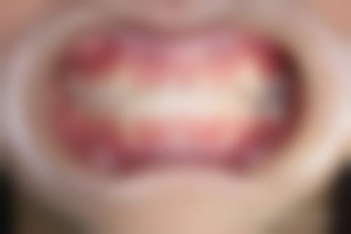 巴彦美皓口腔门诊部真实实例