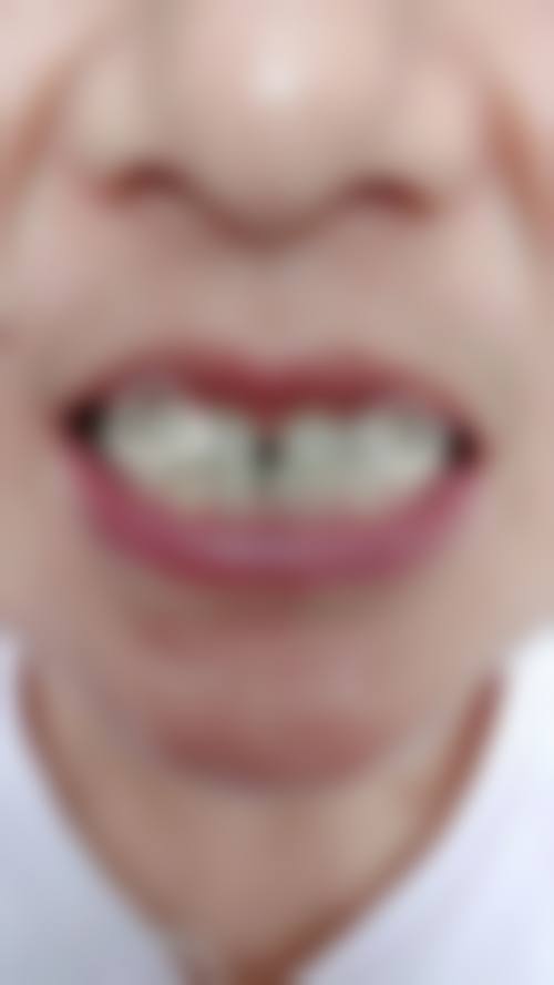 长沙瑞泰科尔雅口腔(西奥门诊部)口碑怎么样