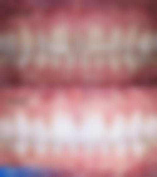 赣州陈庆洲口腔仪器设备：精良科技助力治疗