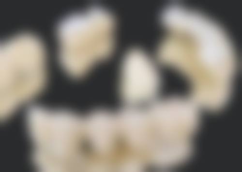 根管治疗后没做牙冠，牙齿使用寿命会缩短吗？