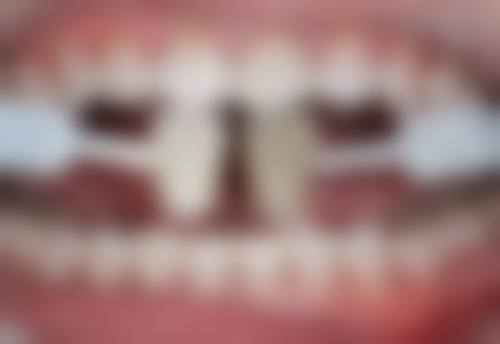 朴浩山院长的看诊优势