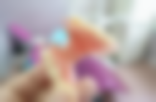 五岁小孩地包天地包天矫正去北京康铂口腔怎么样？