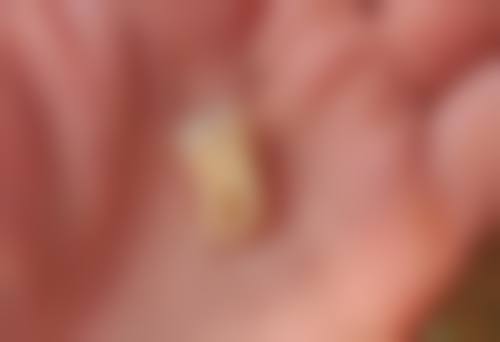 洗牙后避免立即刷牙有必要吗？