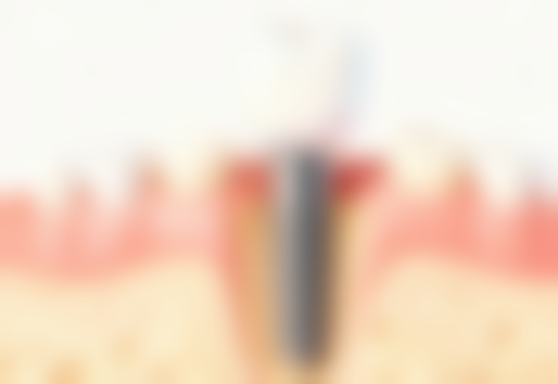 上海正睿齿科嘉一口腔门诊部价格表:性价比极高