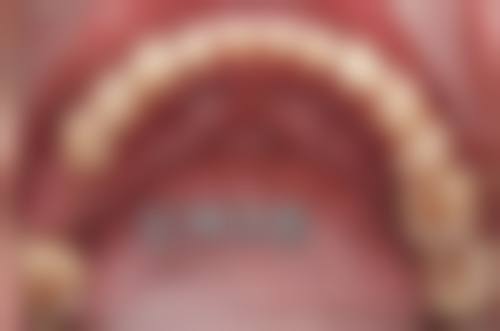 德阳爱佳口腔诊所口碑怎么样:患者的真实评价是更好的证明