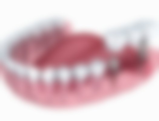 德阳爱佳口腔诊所擅长项目:全方面的口腔解决方案