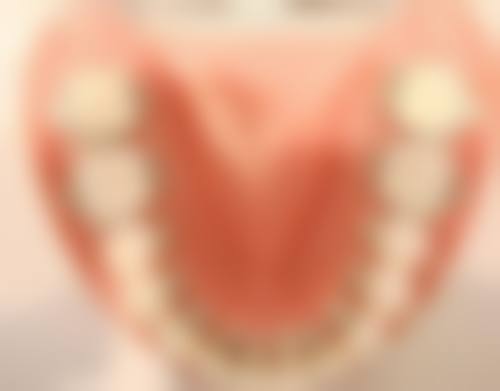 重庆韩佳牙博士口腔医院拔牙后多久种牙适合？