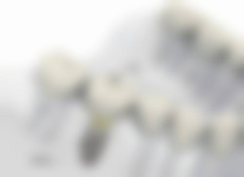 宁波东悦诚适口腔价格表：透明合理的收费