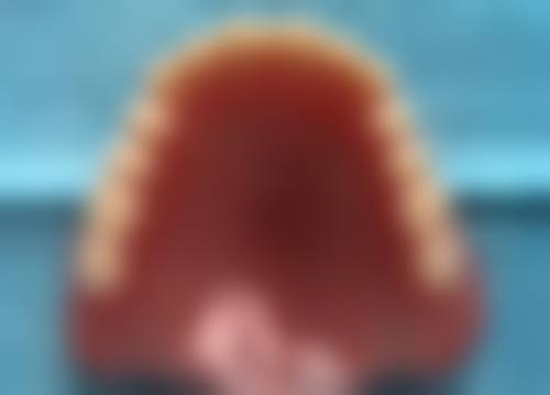 重庆韩佳牙博士口腔医院拔牙后多久进食适合吗?