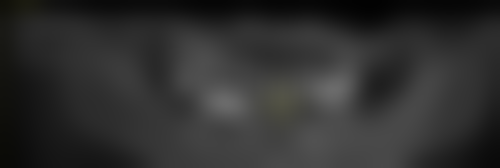 山东临沂兰山金美冠口腔电话号码:一键联系开启诊疗