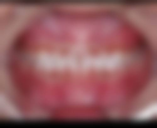 辽宁沈阳非凡口腔门诊部真实实例