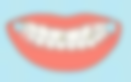 含过氧化氢牙膏美白牙齿成效怎么样?