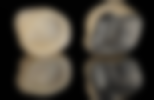 屈克勤医生看诊优势