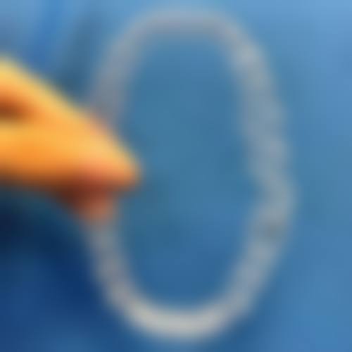 沈阳名流美容医院怎么判断要根管治疗靠谱吗？