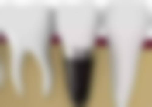 吉林松原上诚口腔擅长项目:满足多样口腔需求