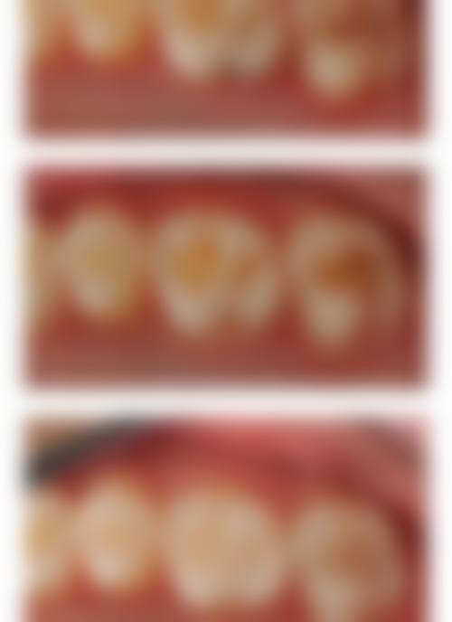 郴州植贝尔口腔门诊部价格表