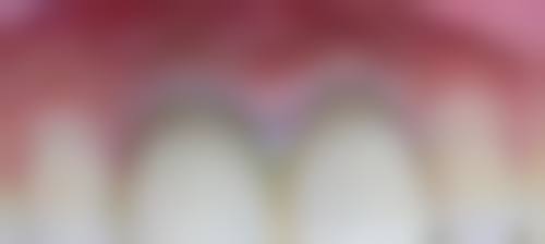 深圳美佳德口腔连锁门诊部口碑怎么样