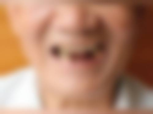 南宁爱思特口腔擅长项目：多领域开花，满足你的多样需求