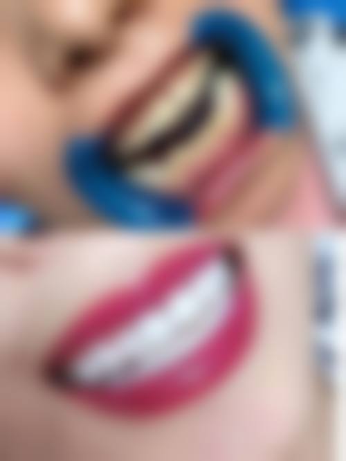 昆山思迈尔口腔真实实例