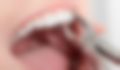 广东东莞佰嘉口腔诊所仪器设备：科技助力口腔治疗