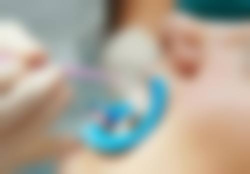 洗牙前一天告知医生健康状况适合吗