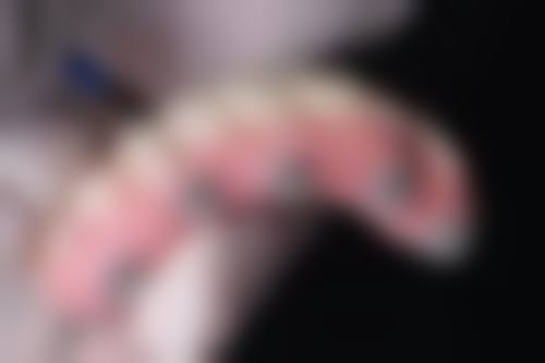 哪些食物有助于拔牙后创口修复?