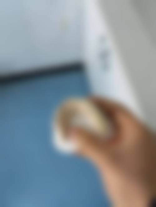 珠海九诺口腔门诊部真实实例：见证神奇成效