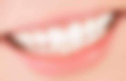 辽宁曙光整形外科医院口腔处理拔牙旁边牙齿松动值不值