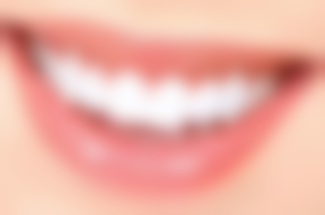 韩国tako达刻整形医院真实实例