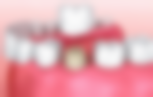 特殊人群洗牙后护理方案需要调整吗?