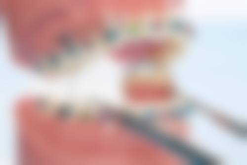 在沈阳杏林整形外科医院拔牙怎么样?有啥好处和坏处?