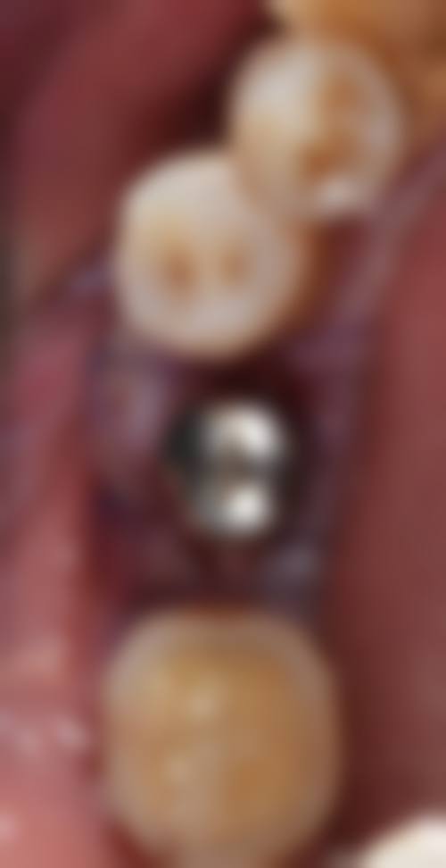 江苏常州星贝口腔擅长项目:满足你的多样需求