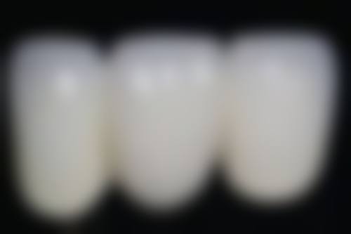 抚顺兰海口腔门诊部的儿童牙齿早期矫治怎么样