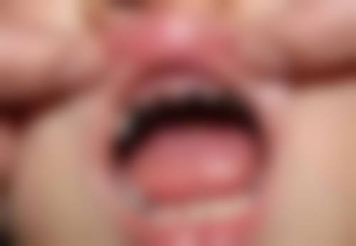 嘉兴嘉诚口腔医院补牙流程需要多长时间值不值?