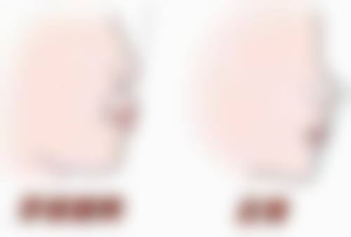 哪些因素影响全瓷牙冠的使用年限，在正规医院做全瓷牙成效怎么样？