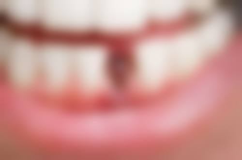 新郑华悦口腔门诊部口碑怎么样：患者真实评价见证