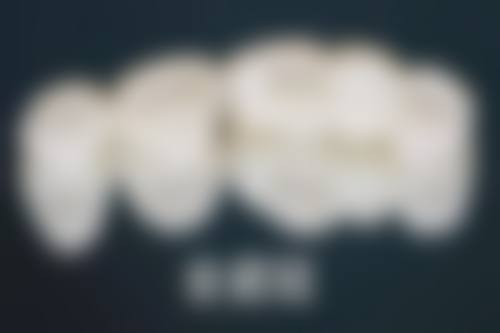 根尖周病的牙齿选择根管治疗,适合吗?