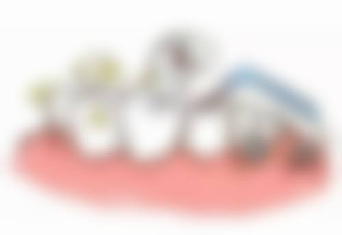 王元琴医生真实实例:见证神奇的口腔蜕变